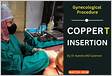 2 Copper T Insertion Doctors in Hyderabad